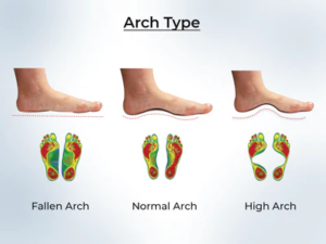 Foot arches and weight distribution