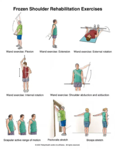 exercises for frozen shoulder