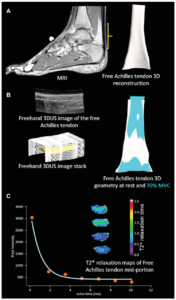 Imaging of achilles 