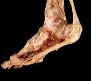 Anatomical plantar fascia