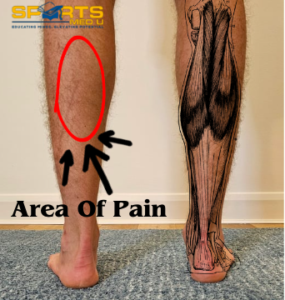 Location of calf strain