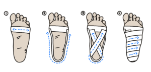 Taping for plantar fasciitis