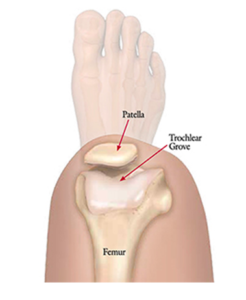 Troclear groove