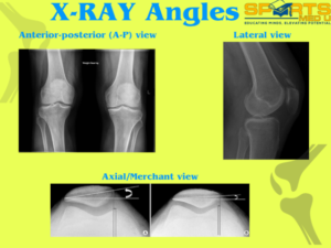 Images of knee x ray