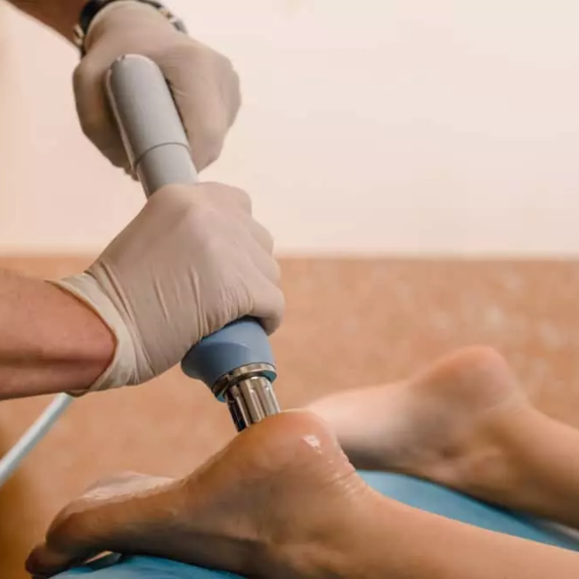 shockwave therapy plantar fasciitis