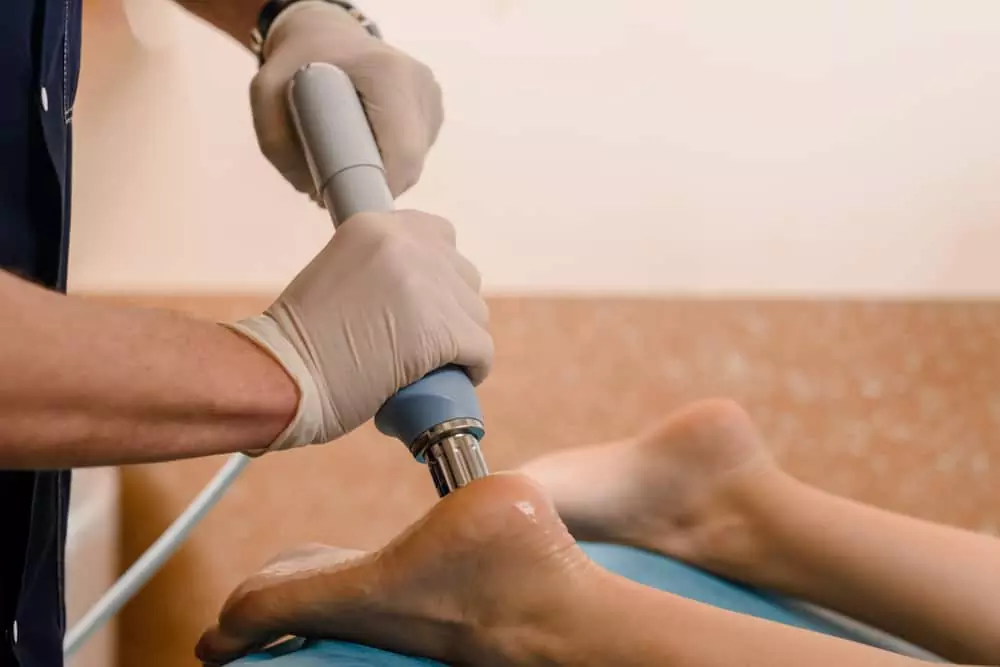 shockwave therapy plantar fasciitis